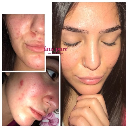 cit face roller anmeldelse cit face roller anmeldelse