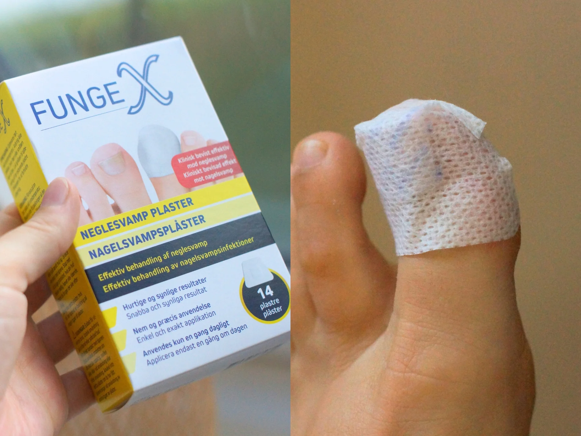 plaster til behandling af neglesvamp fra fungex