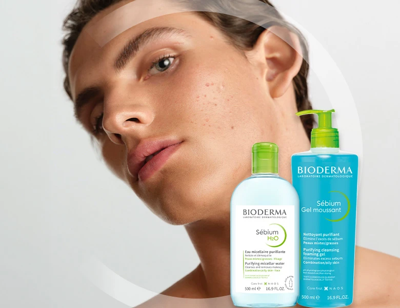 En person med urenheder i huden med Bioderma Sébium H2O micellarvand og Sébium rensegel til kombineret/fedtet hud.