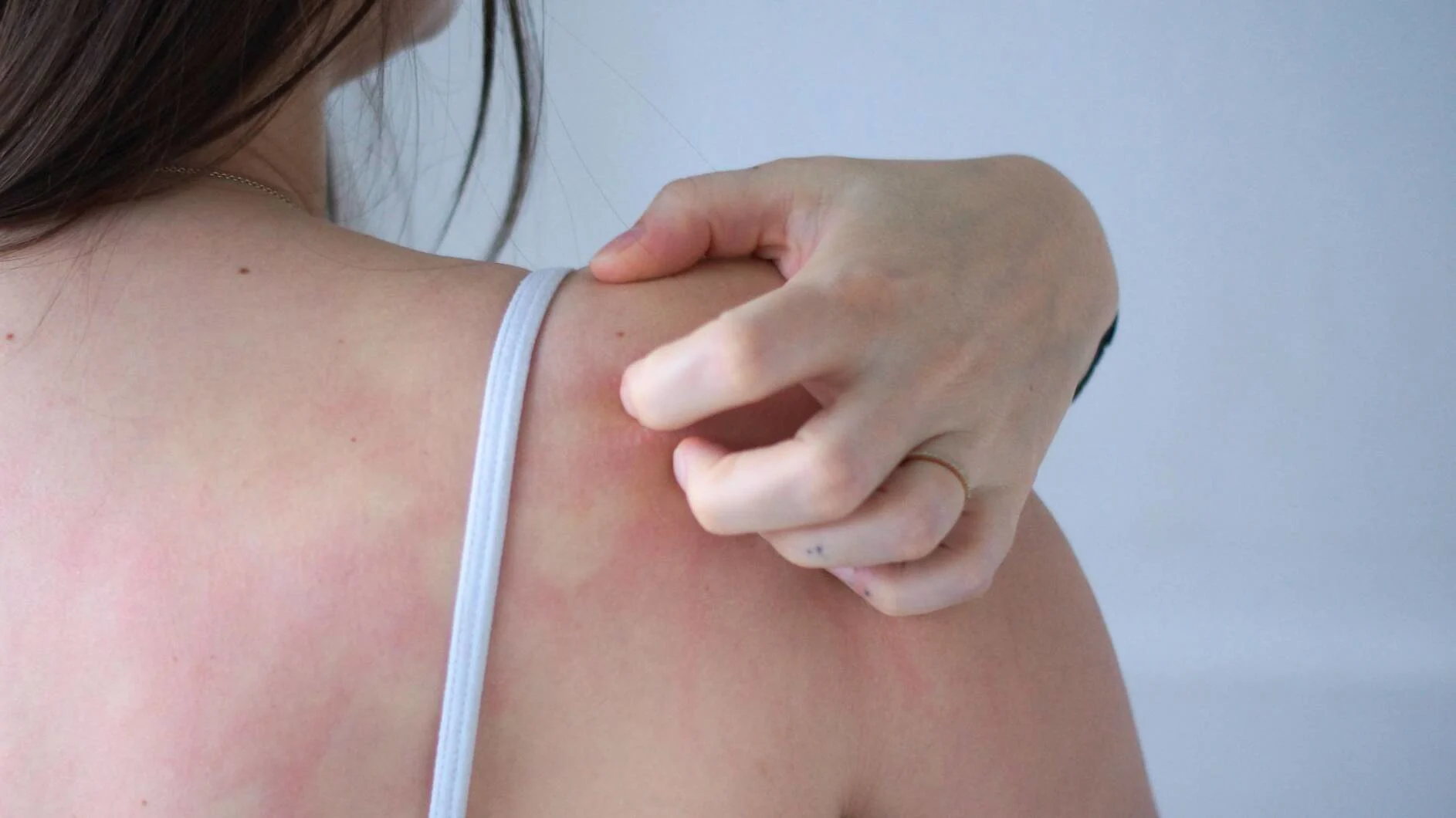 A-DERMA banner.jpg