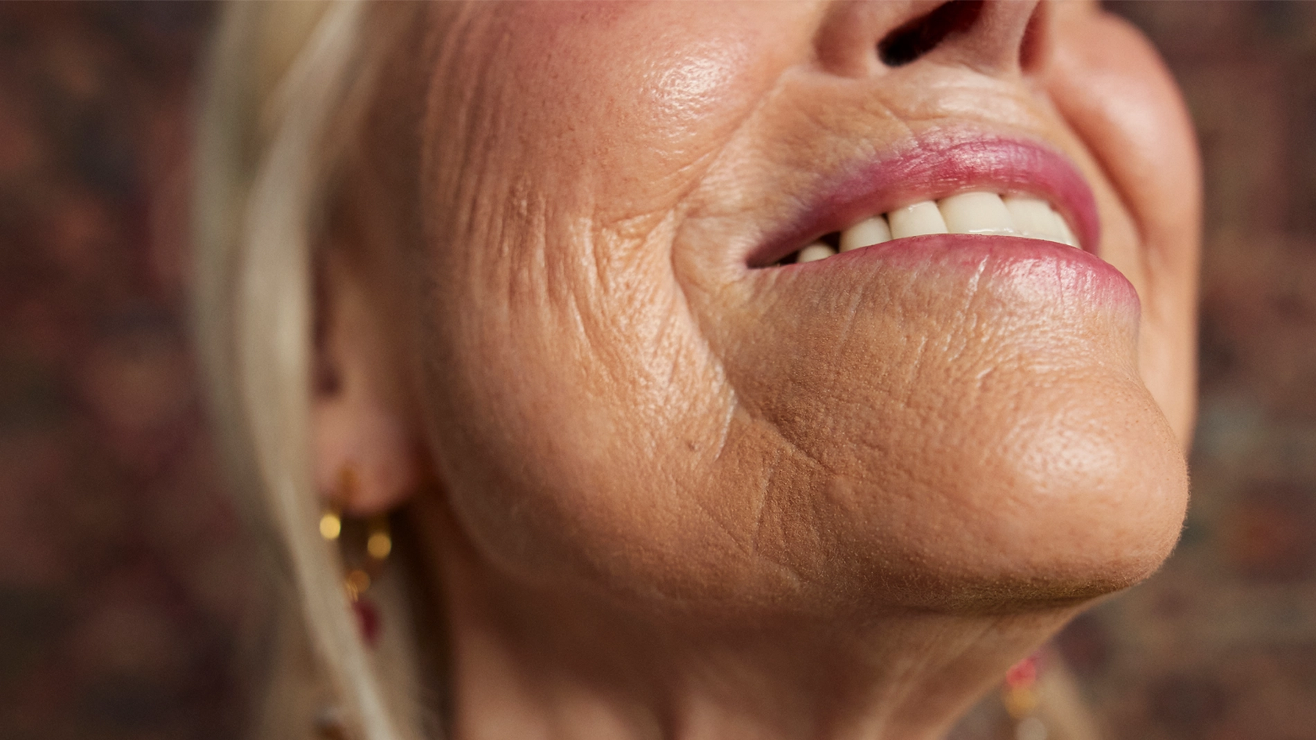 Närbild av en persons nedre ansikte och hals mot suddig bakgrund. Personen ler med lätt synliga tänder. Huden runt mun, haka och hals är tydligt synlig med naturlig struktur. Personen bär små örhängen.