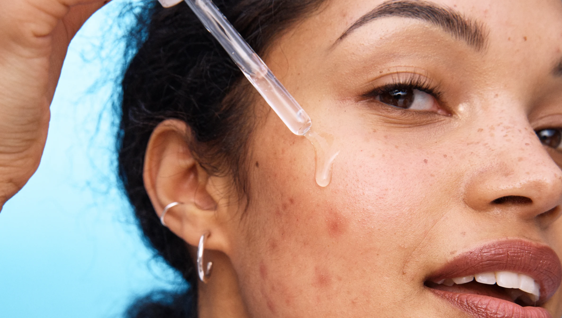 En person påfører serum med en pipette på kinnet, som har noen røde urenheter.