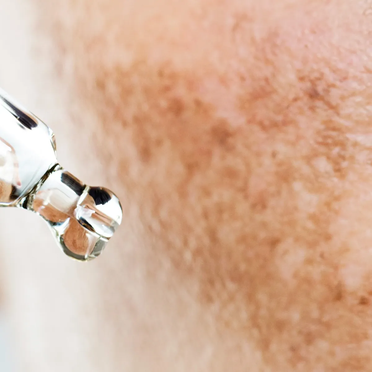 Nærbilde av en pipette som påfører serum på huden.