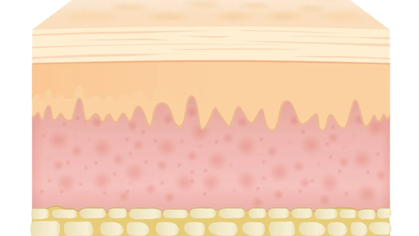 En illustration av hudens lager.