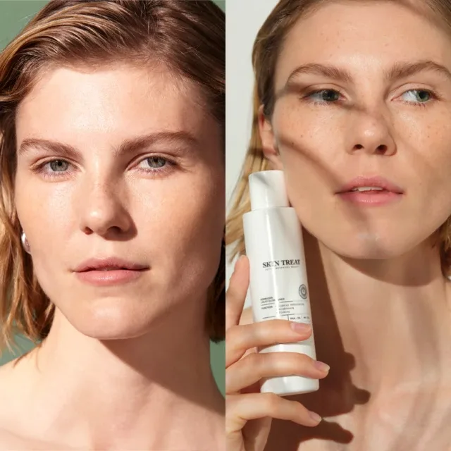 Två bilder sida vid sida. Den vänstra bilden visar en kvinna med blont hår mot en grön bakgrund. Den högra bilden visar en kvinna som håller en vit flaska med texten "SKIN TREAT" mot en ljus bakgrund.