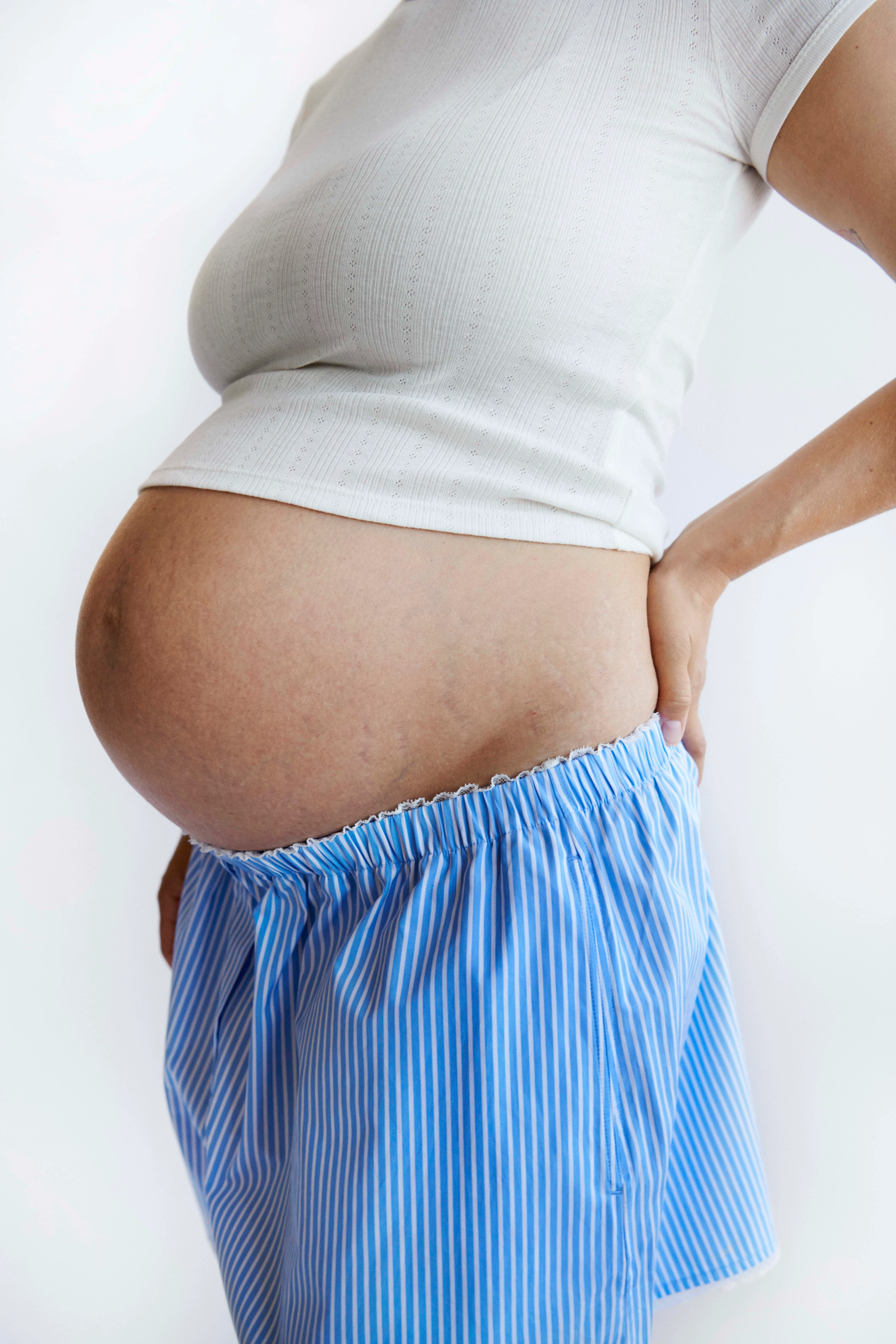 Sidebillede af en gravid person i hvid top og blå- og hvidstribede shorts, der viser en tydelig babybule.