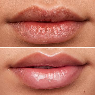Wonderskin Lip Rehab Serum Oil Clear
