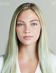 Pieni kuva 3