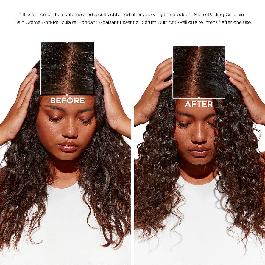 Symbiose Bain Creme Anti-Pelliculaire Shampoo