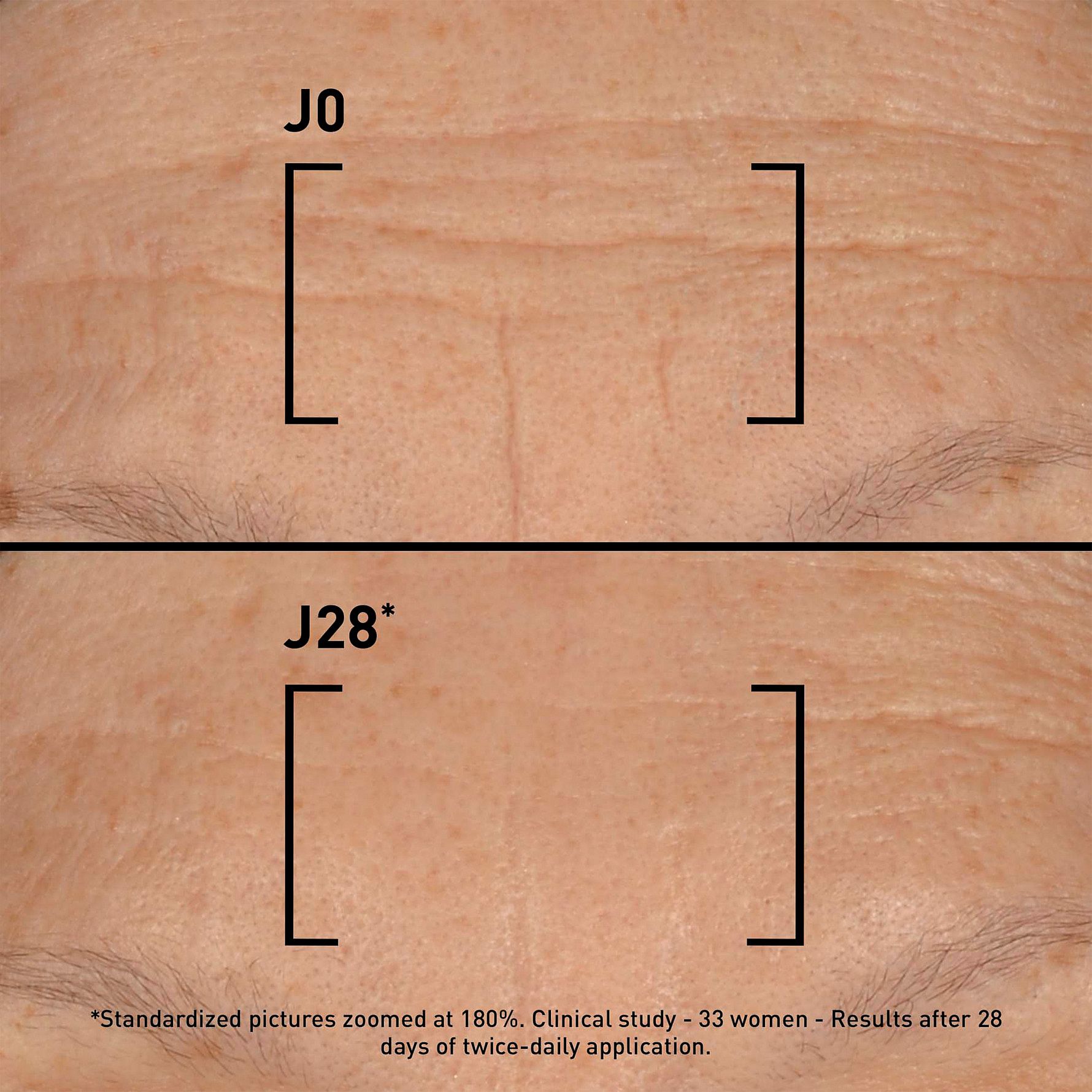 Time-Filler 5XP Cream