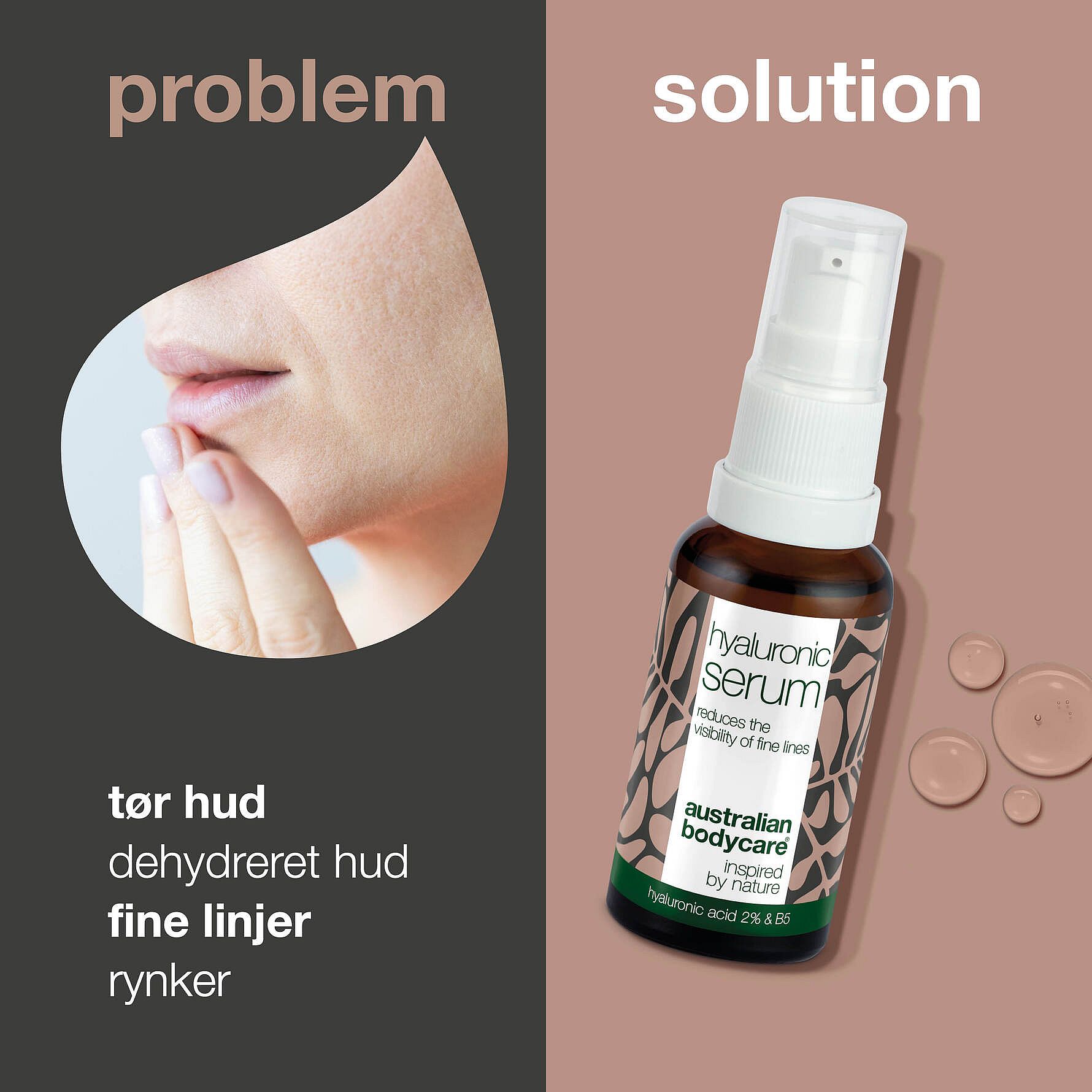 2% Hyaluronic Acid Serum – Hydrates, Soothes And Softens Sensitive Skin