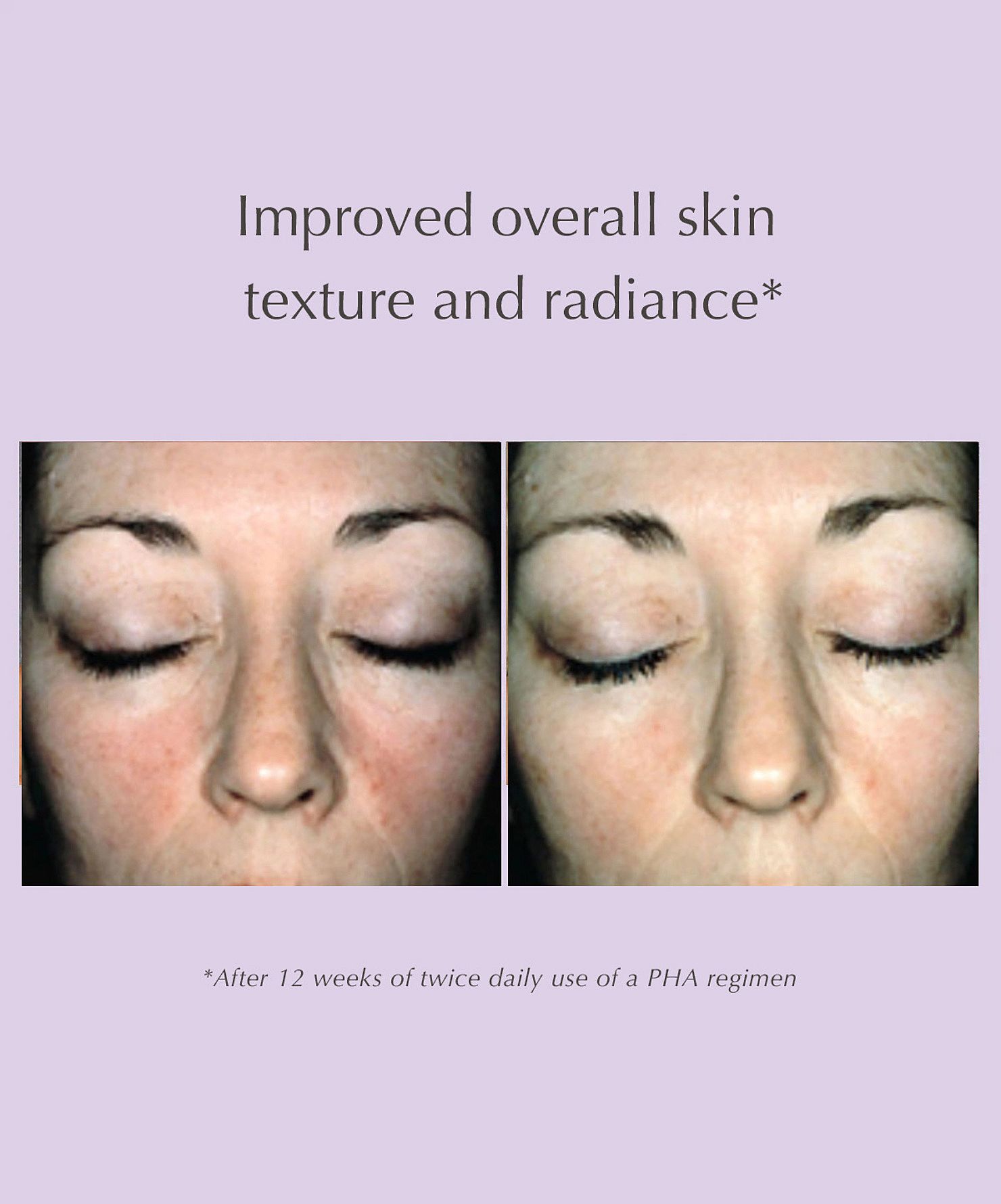 Glycolic Expert Moisturizer