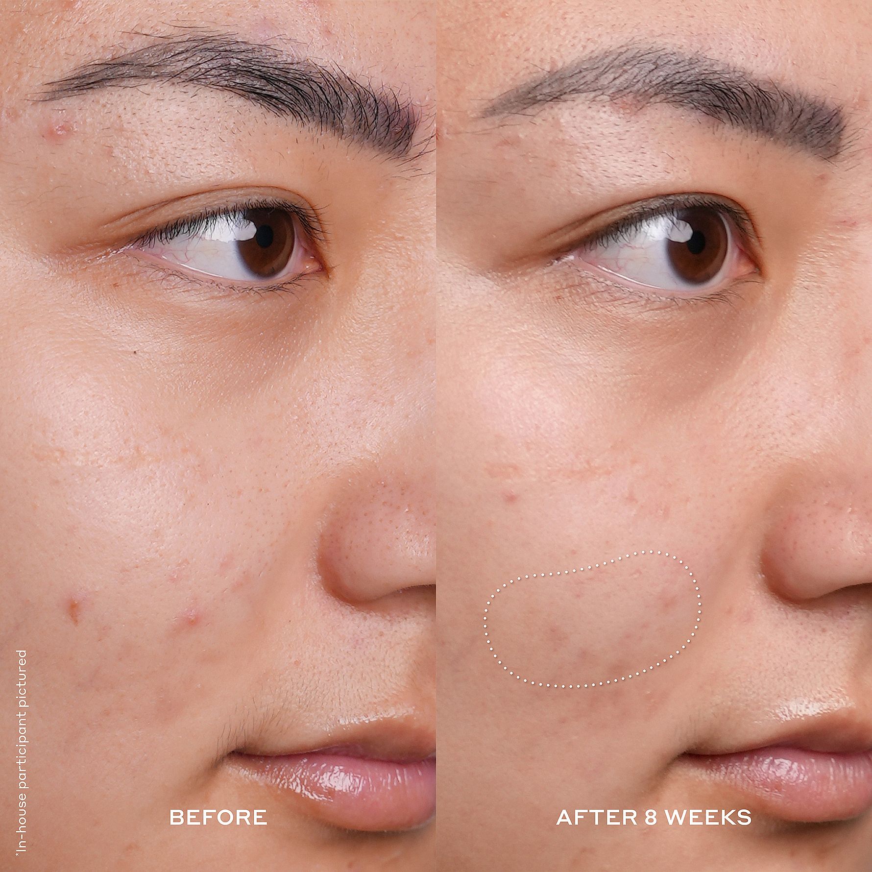 Banana Bright™ Vitamin C Serum