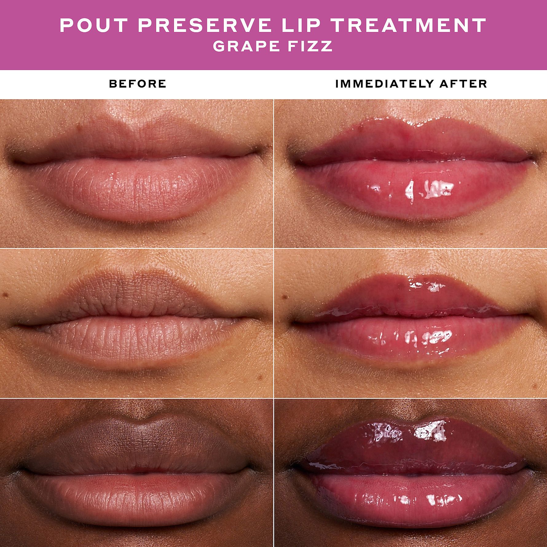 Plumped Up Peptides Gift Set