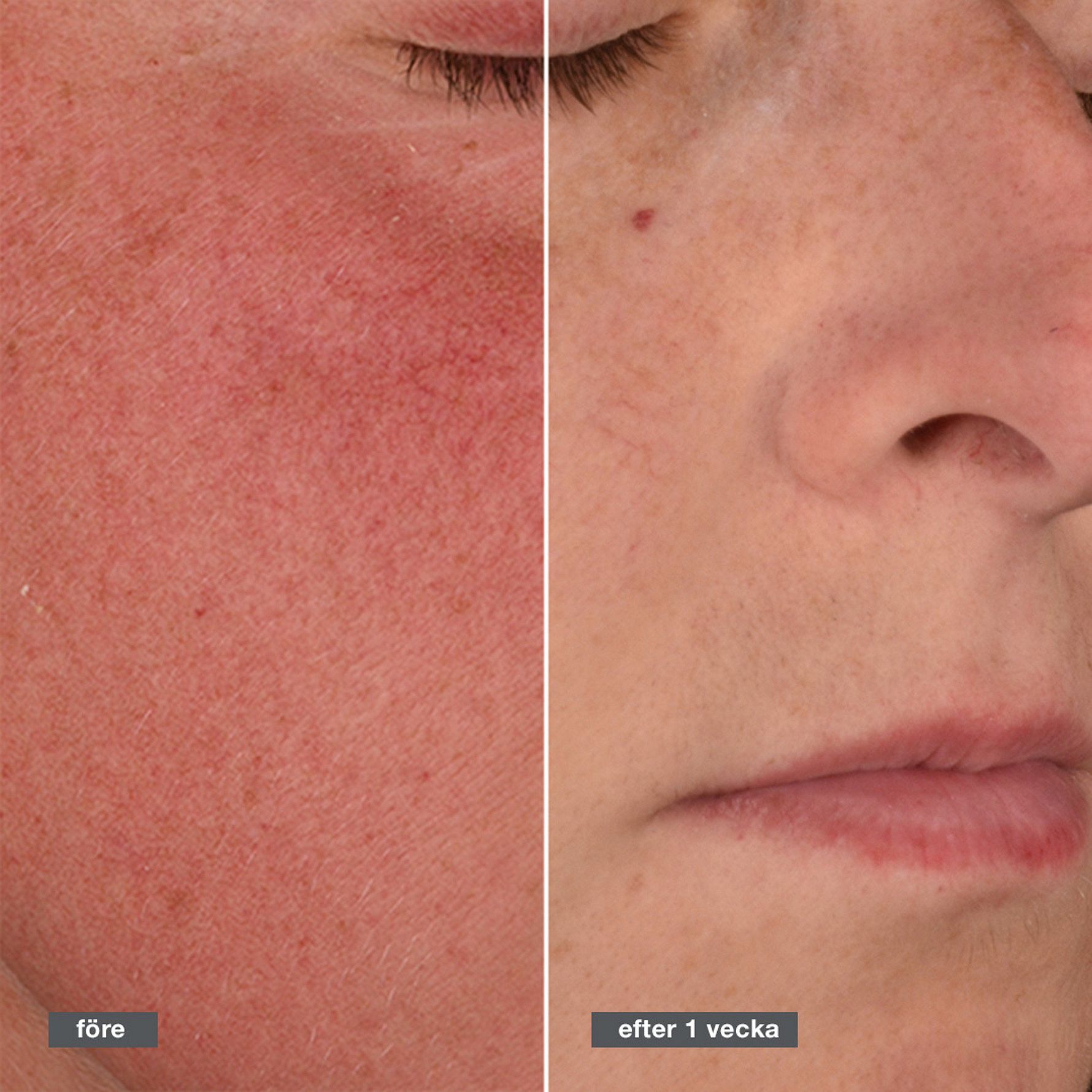 Stabilizing Repair Cream