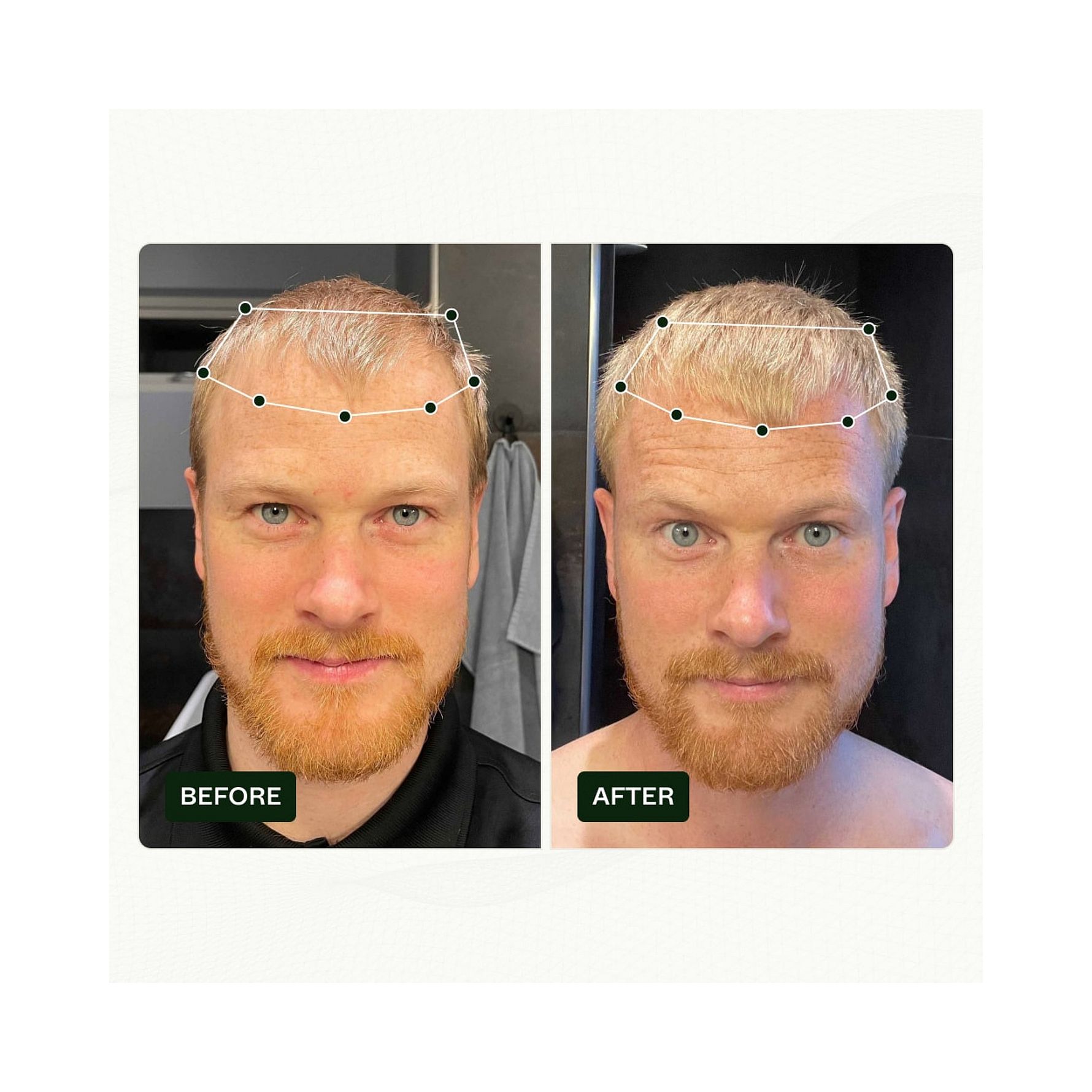 Bio-Pilixin® Serum+ For Men