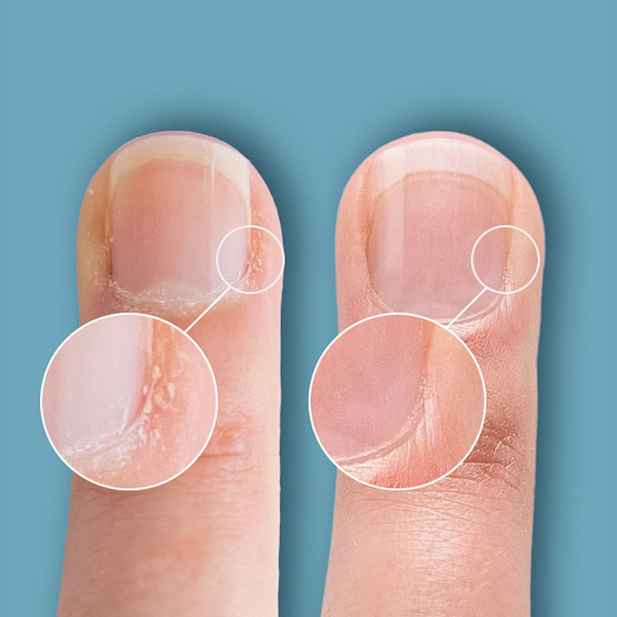 Køb Cuticle Eraser Gentle Exfoliator 15 ml fra CND Matas